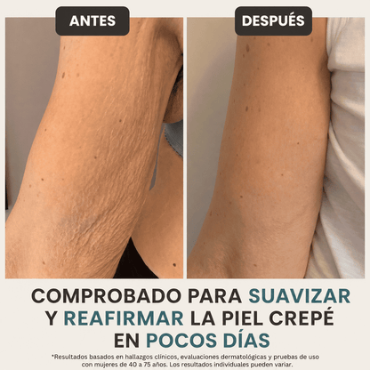 VeynaCare Crema de Manos con Retinol